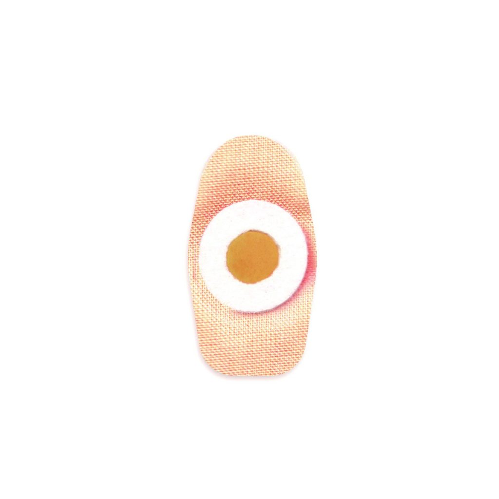 Wart Small